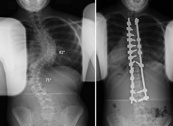 Orthopedic Care