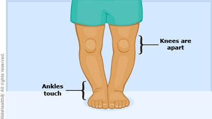 Bone Treatment