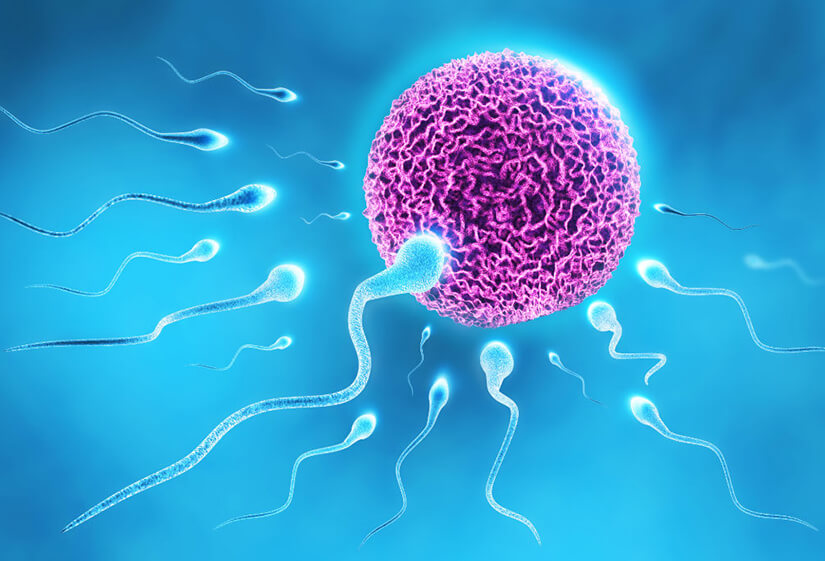 IVF