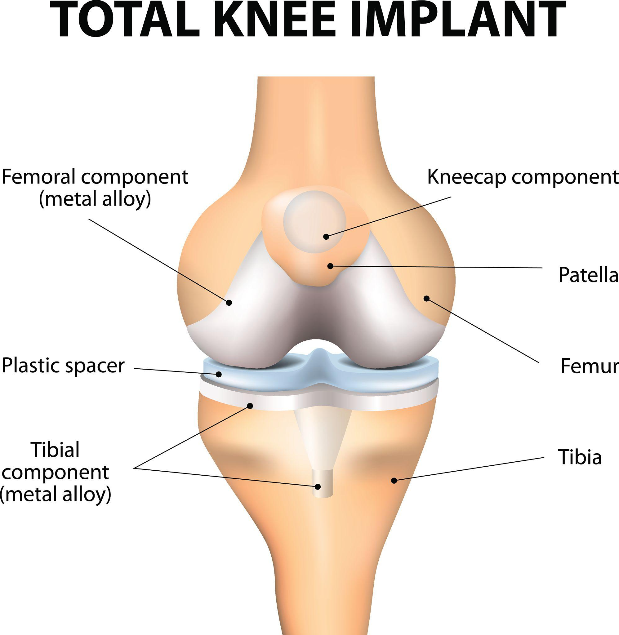 Orthopedic Care