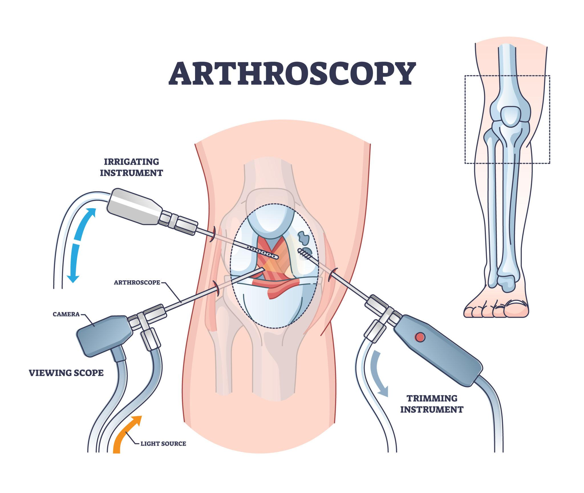 Bone Treatment